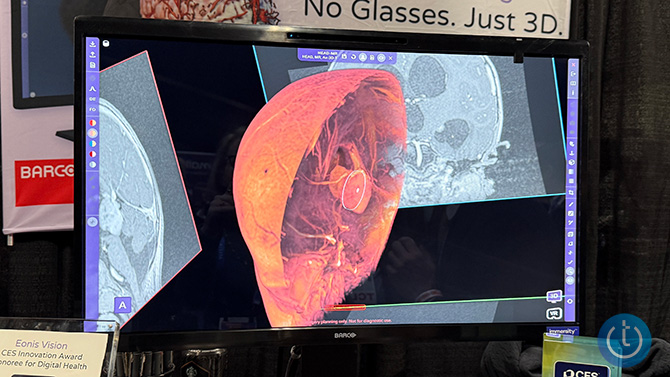 A demo of the 3D imaging technology enabled by Eonis Vision of a brain.