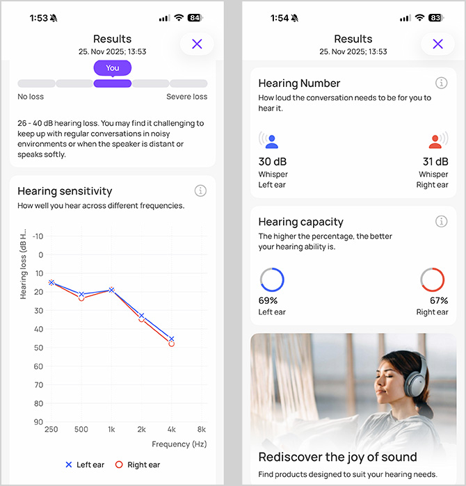 Hearing test results as shown in the Horizon app. On the right is the dB HL score and on the left you see the frequency chart.